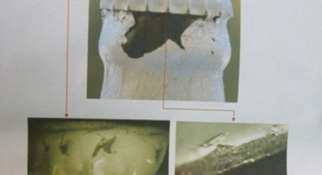  Lo ngại bia có dị vật, nước giải khát độc hại 
